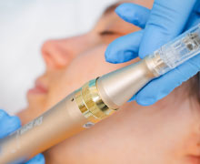 Dermapen - Mezoterapia fractionala