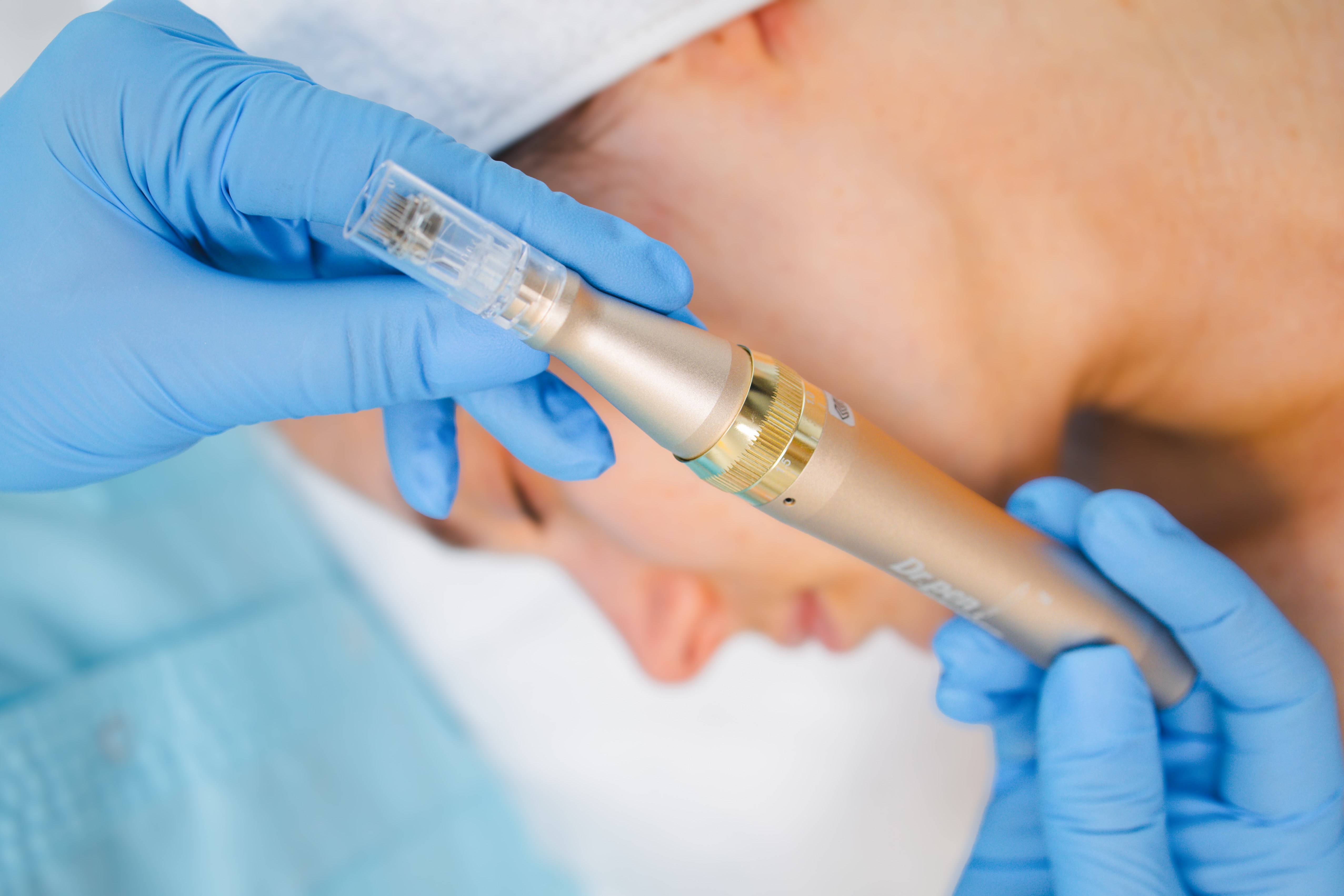 Аппарат Doctor Pen (Dermapen)