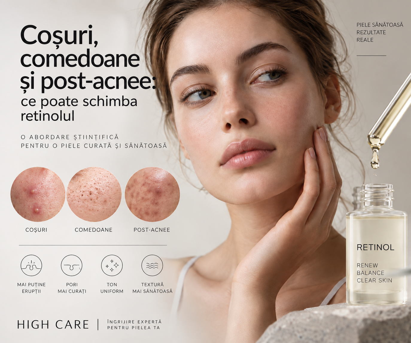 Biostimulatori de colagen pentru față: Juvelook, Lenisna și AestheFill